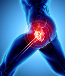 an xray image of a torso showing a red section of inflamation at the hip